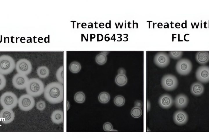 Breakthrough Treatment Unveiled to Combat Fungal Infections