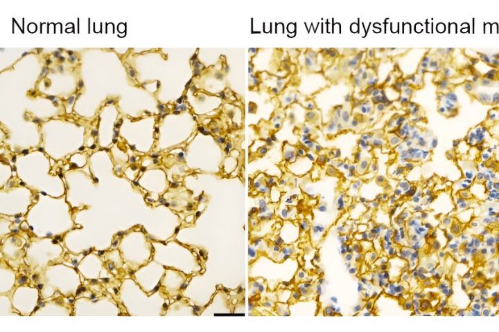 Mitochondria Control Cellular Signaling for Optimal Lung Development, Study Reveals