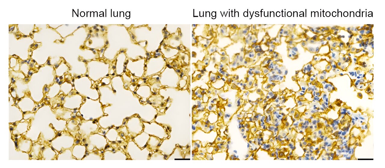 Mitochondria Control Cellular Signaling for Optimal Lung Development, Study Reveals