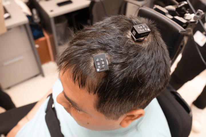 World-First Double Neural Bypass Partially Restores Movement and Sensation for Paralyzed Man