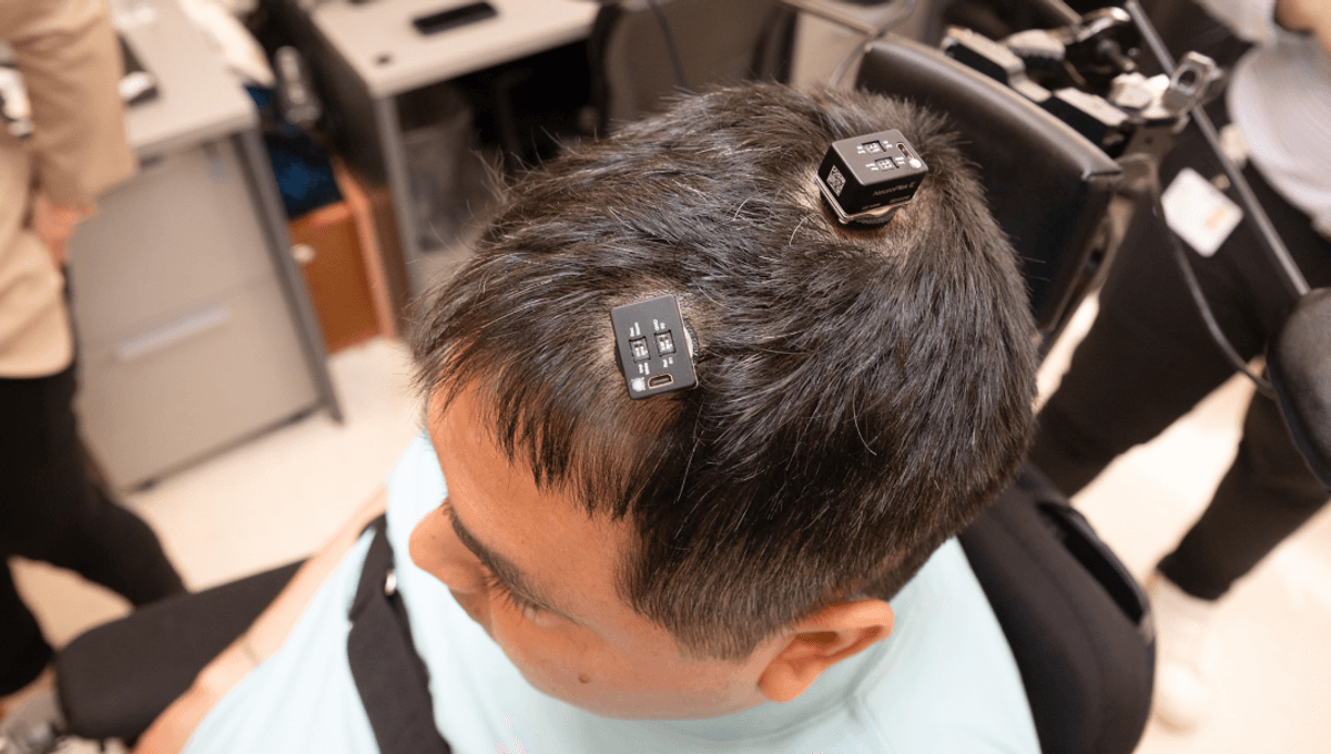 World-First Double Neural Bypass Partially Restores Movement and Sensation for Paralyzed Man