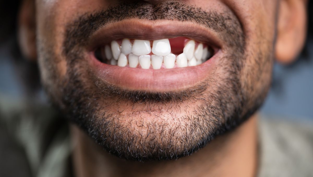 Tooth Regeneration Breakthrough May Pave Way for Living Fillings