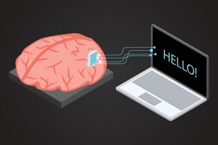 Breakthroughs in Brain-Computer Interfaces Aid Paralyzed Patients in Speaking