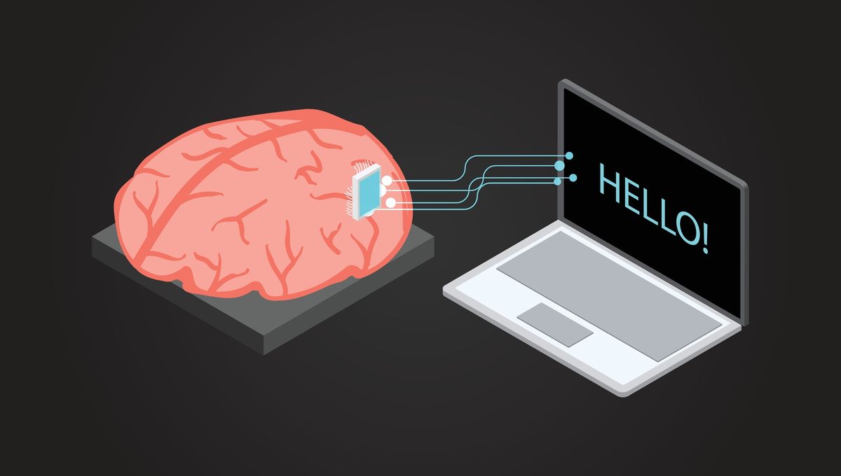 Breakthroughs in Brain-Computer Interfaces Aid Paralyzed Patients in Speaking