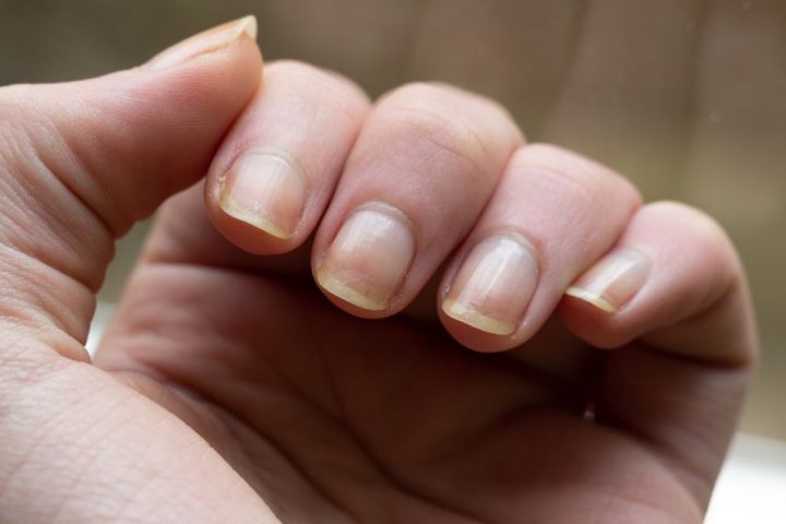 What Your Hands Reveal About Your Health