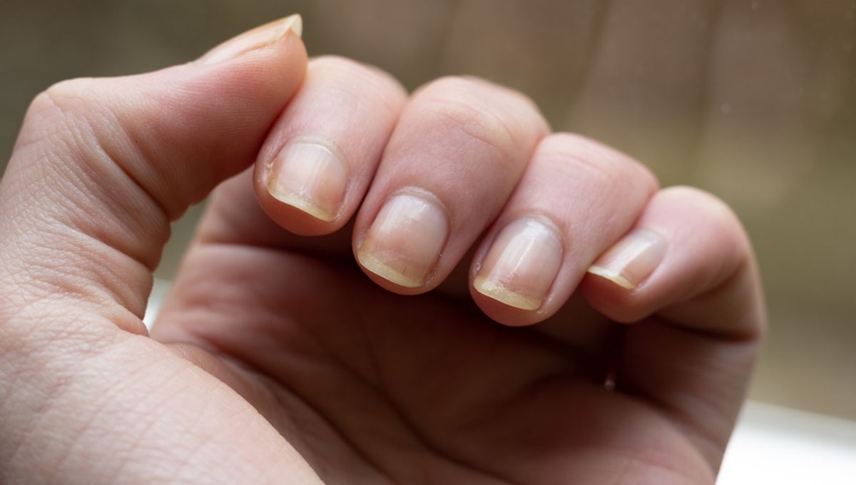What Your Hands Reveal About Your Health