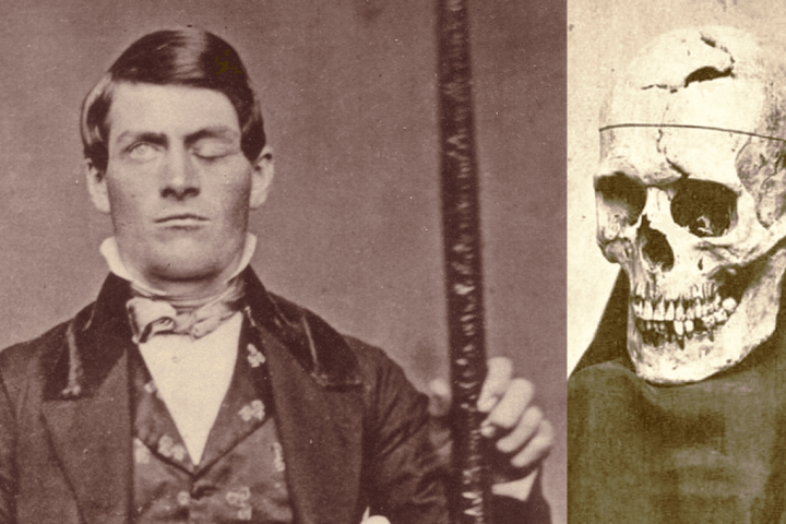 The Revolutionary Impact of Phineas Gage’s Skewered Brain on Medical Science