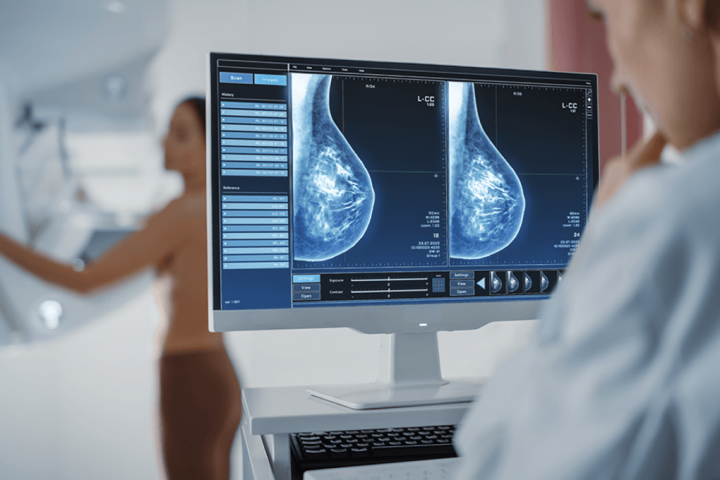 Global Cancer Cases in Under 50s Surge by 79%