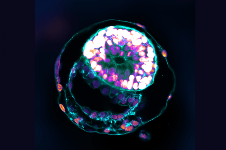 Complex Human Embryos Models Developed via Stem Cells in Laboratory