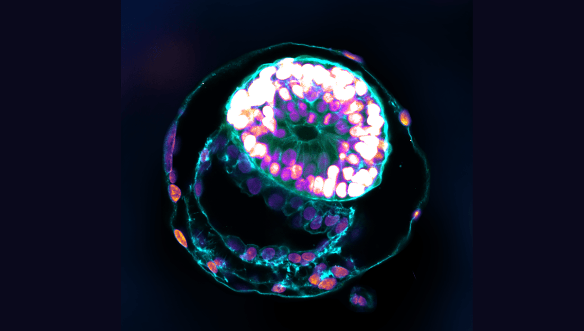 Complex Human Embryos Models Developed via Stem Cells in Laboratory