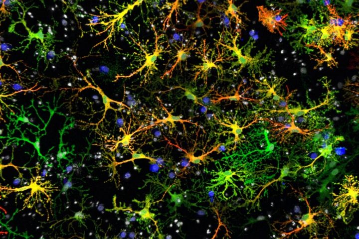 New Brain Cell Discovery Set to Revolutionize Neuroscience Research