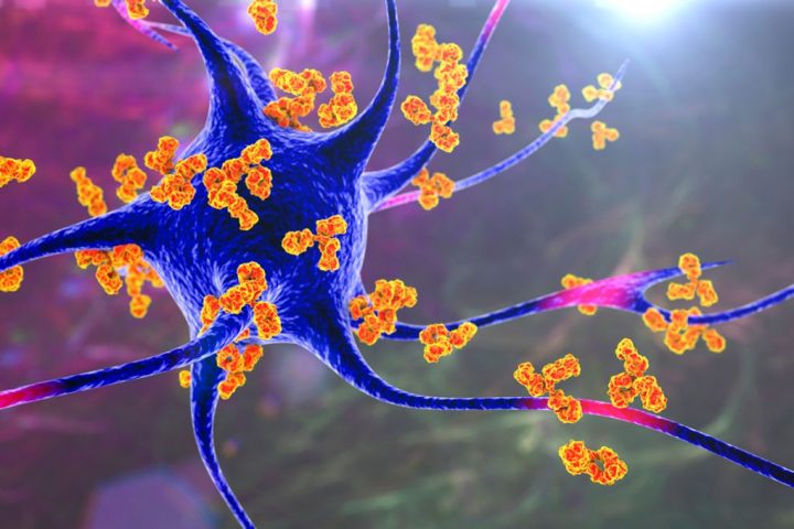 Inverse Vaccine May Reverse Symptoms of Multiple Autoimmune Diseases