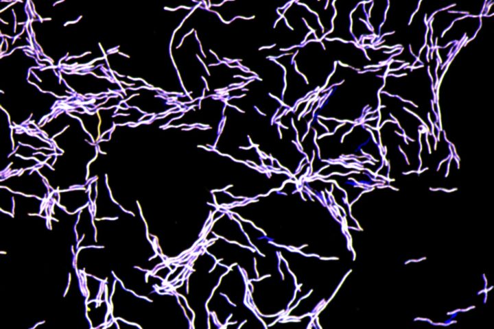 Newly Discovered Gut Microbe Emanates Foul-Smelling Toxic Gas While Safeguarding Against Harmful Pathogens
