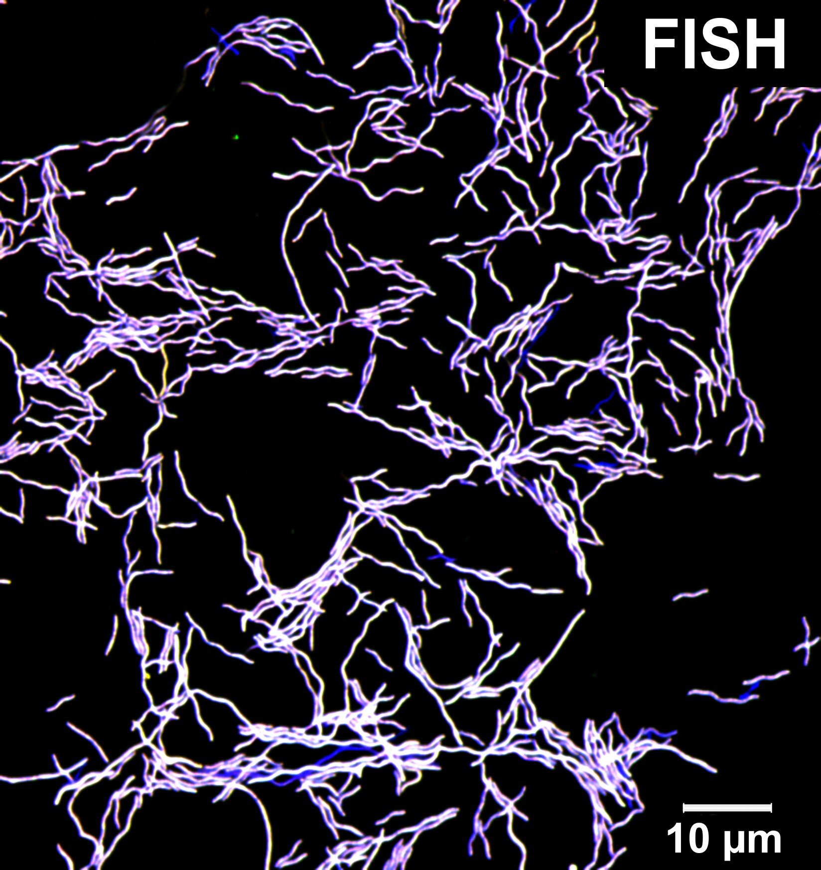 Newly Discovered Gut Microbe Emanates Foul-Smelling Toxic Gas While Safeguarding Against Harmful Pathogens