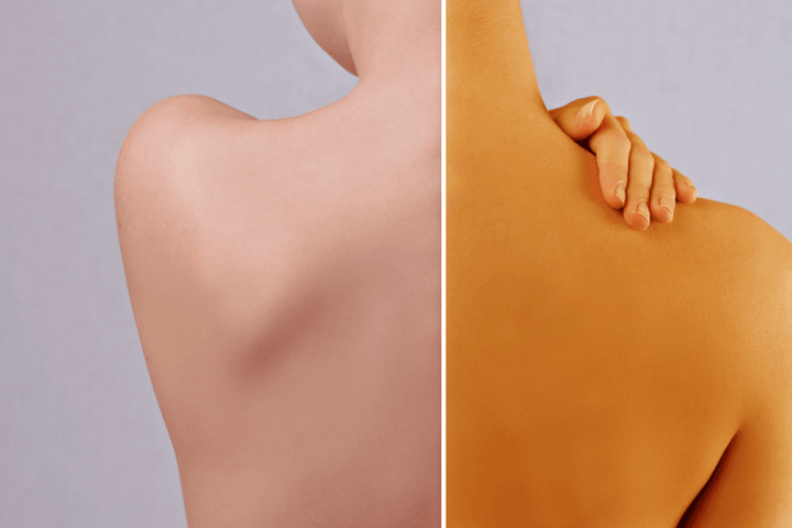 People Trying to Get Tans by Consuming Carrots, Apparently
