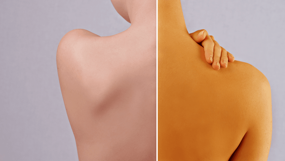 People Trying to Get Tans by Consuming Carrots, Apparently
