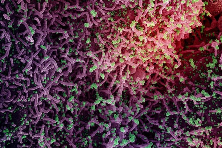 First Virus Unearthed by Science