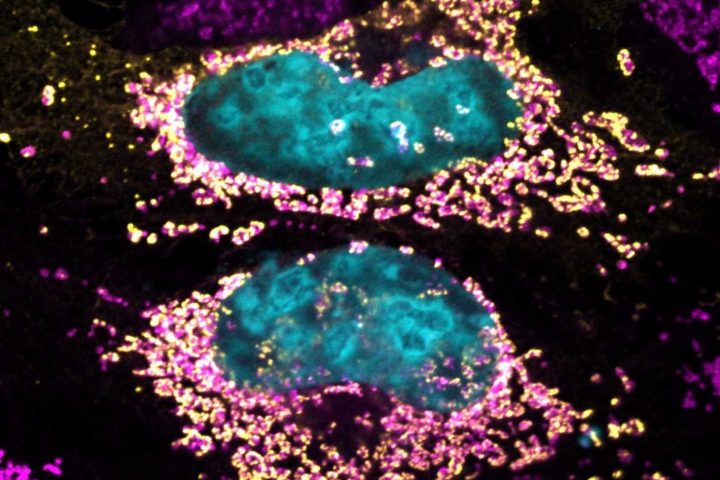 Study uncovers bacterial protein’s potential to maintain human cell health