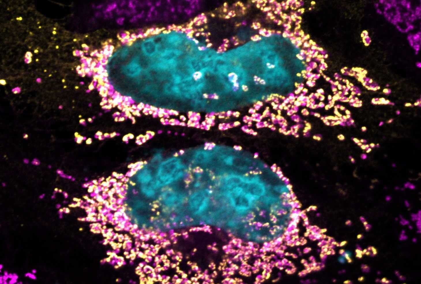 Study uncovers bacterial protein’s potential to maintain human cell health