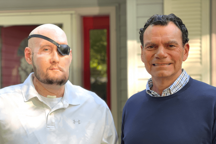 World’s First Eyeball and Partial-Face Transplant Achieves Remarkable Success