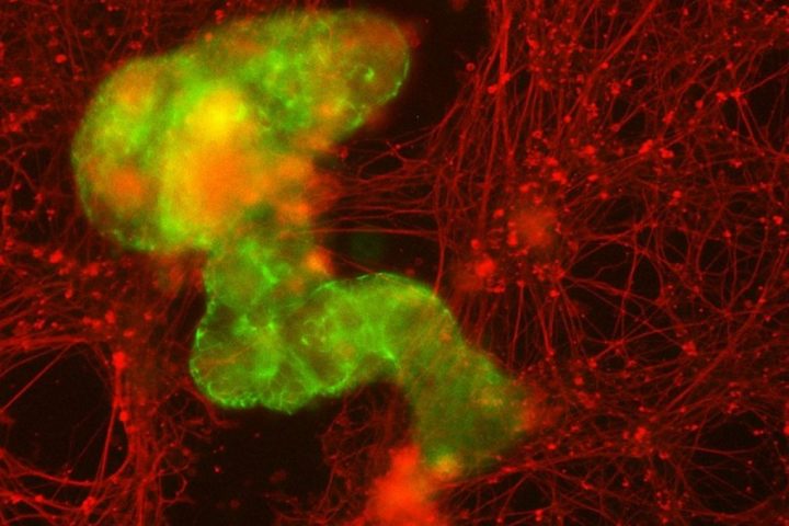 Tiny Wound-Healing Robots Begin as Single Human Cell